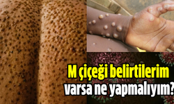 M çiçeği belirtilerim varsa ne yapmalıyım?