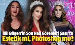 İdil Bilgen’in Son Hali Görenleri Şaşırttı: Estetik mi, Photoshop mu?