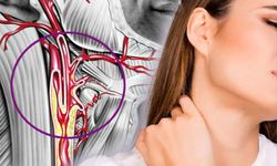 Şah Damarı Tıkanıklığı Felç Riskini Artırıyor, Uzmanından Uyarılar