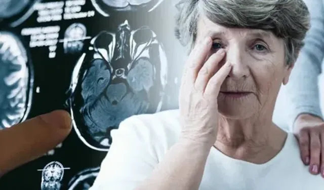 Uzmanından Alzheimer hastalığı belirtileri açıklaması