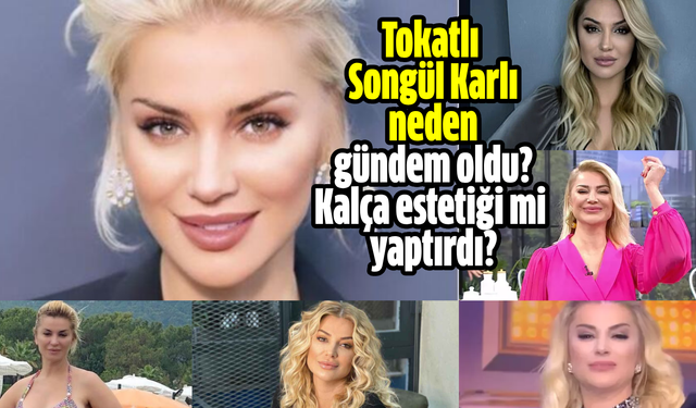 Tokatlı ünlü şarkıcı Songül Karlı neden gündem oldu? Kalça estetiği mi yaptırdı?