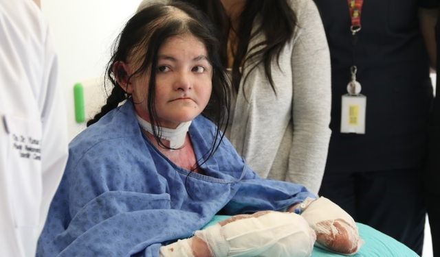 Amerikalı Ledesa’nın parmakları evinden 9 bin 930 kilometre ötedeki Eskişehir’de açıldı
