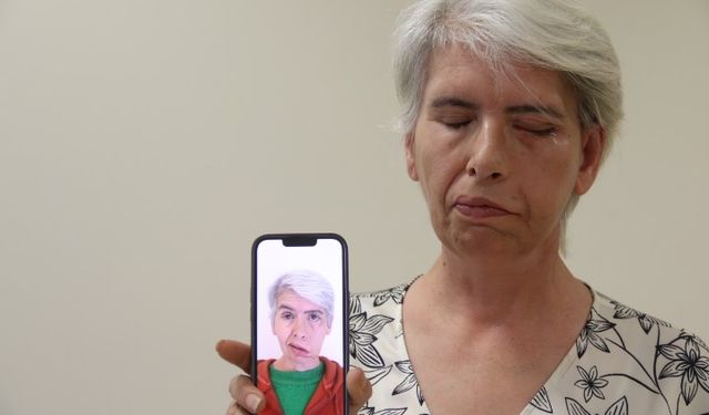Sol gözünü 30 yıl sonra 24 ayar altınla yapılan tedavi sonucu kapattı
