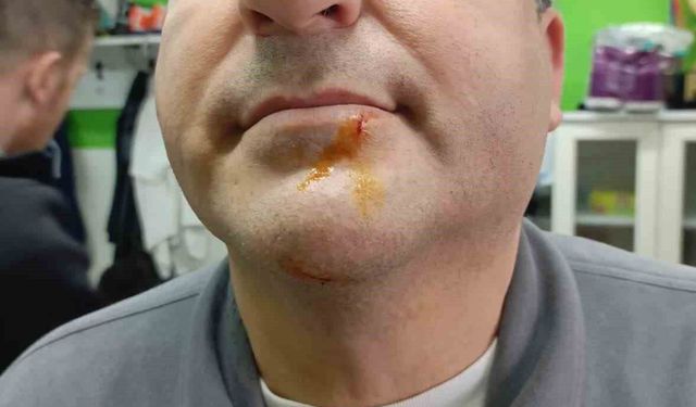 Zonguldak'ta 3. Lig maçı sonrası gerginlik: 2 gazeteci darbedildi, 2 polis yaralandı