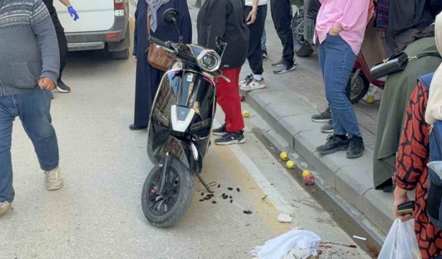 Scooterin çarptığı yaya yaralandı