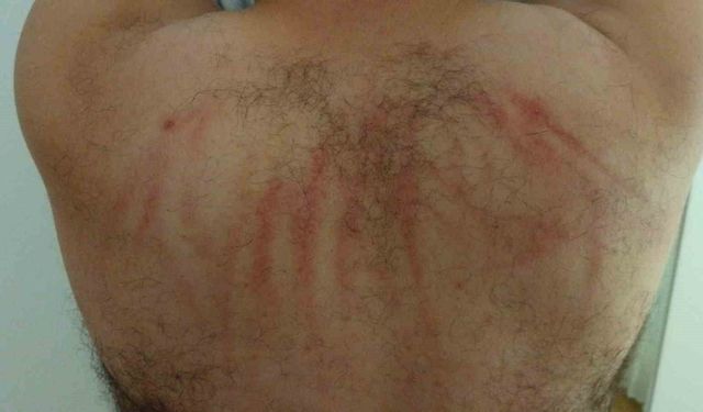 Beyzbol sopalarıyla darbedildi: O anlar kamerada