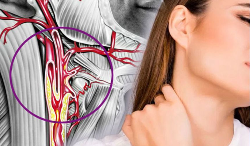 Şah Damarı Tıkanıklığı Felç Riskini Artırıyor, Uzmanından Uyarılar