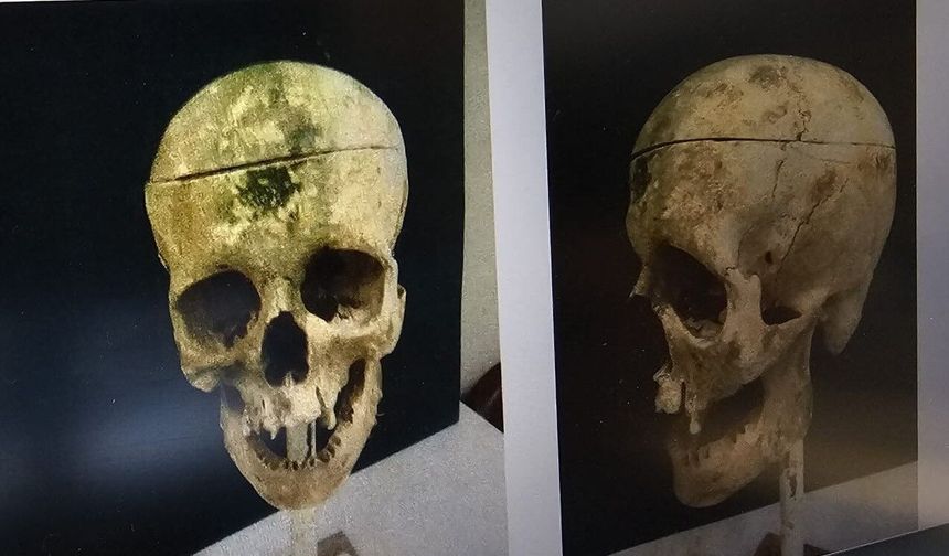 Barajdaki kemiklerle 18 yıllık cinayetin sırrı çözüldü