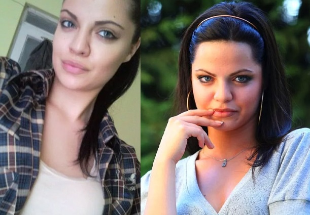 hilal-altYnbilek-estetiksiz-hali