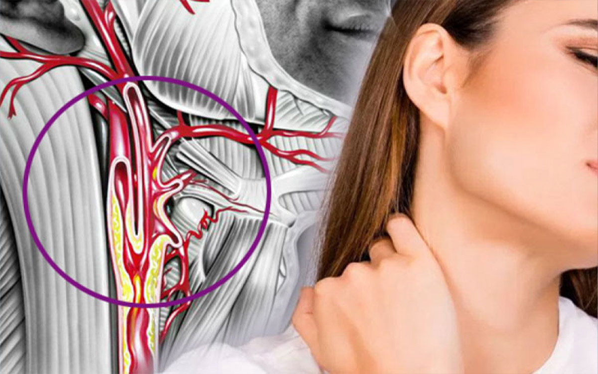 Sah Damari Tikanikligi Risk Faktorleri 01